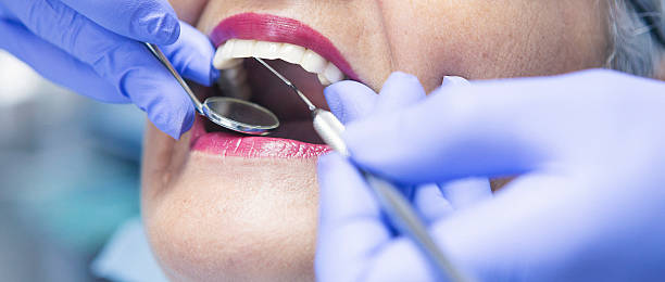 Best Emergency Treatment for Dental Infections or Abscesses in Fridley, MN